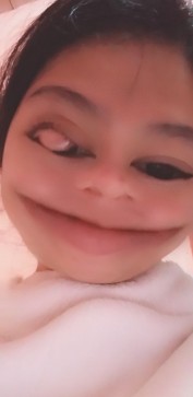 Shine, 25, Philippines