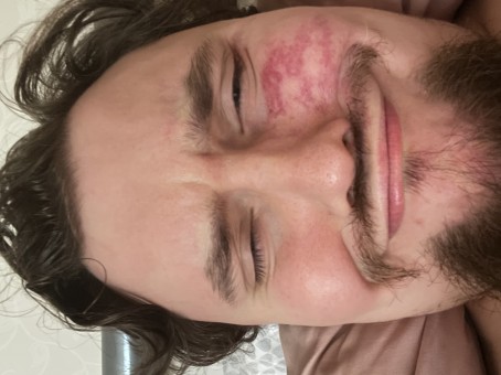 , 24, United Kingdom