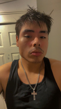 Storm , 20, United States